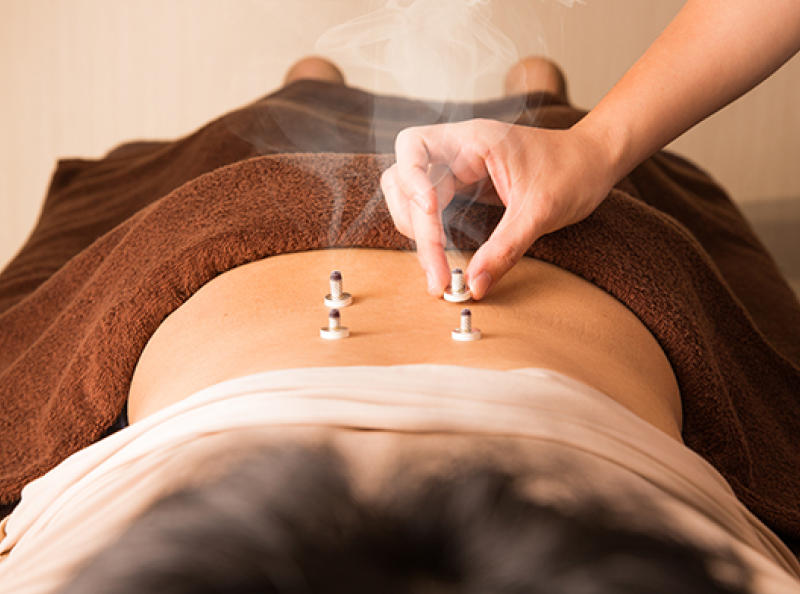 鍼灸院 施術風景